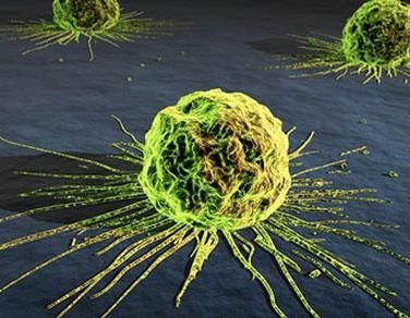 Lotta al cancro: è nata la rete oncologica veneta