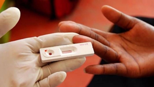 HIV e AIDS in Veneto: mai trascurare il pericolo di contagio